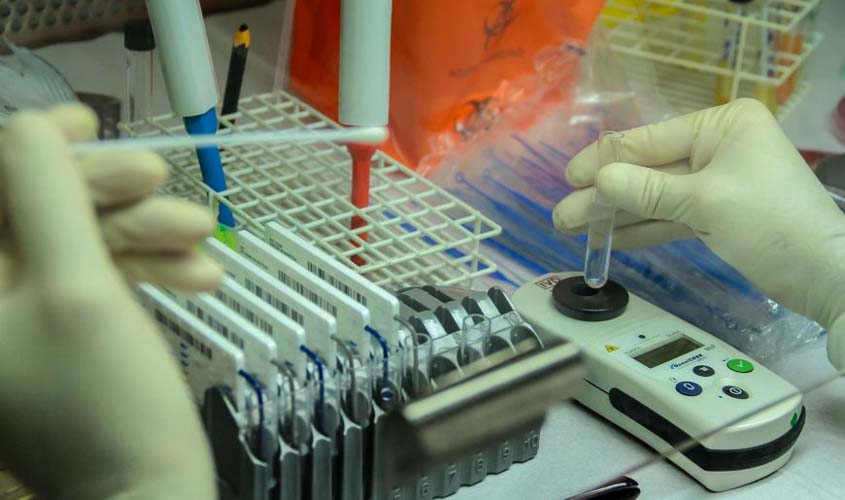 Boletim diário sobre o coronavírus em Rondônia