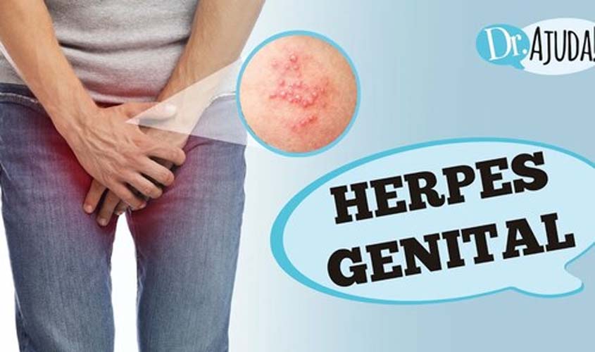 HERPES GENITAL: O que é? Quais sintomas e tratamentos