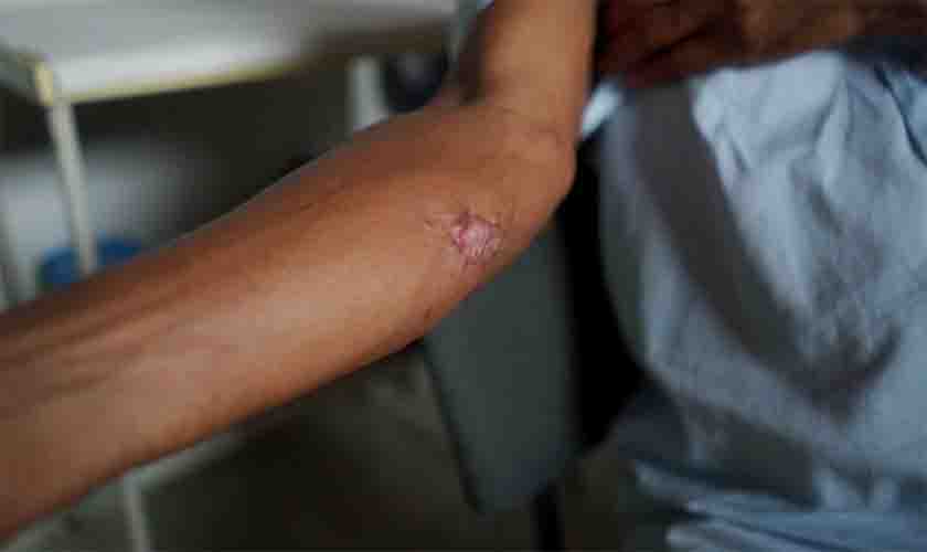 Doença de Chagas e leishmaniose são o tema do Caminhos da Reportagem