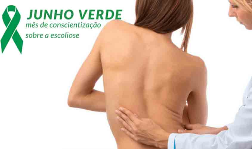 Diagnóstico e tratamento da escoliose idiopática celebrado no Junho Verde