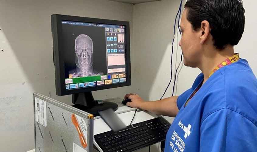 Rede Municipal realiza mais de 43 mil exames de raio-x e avança na saúde pública em Porto Velho