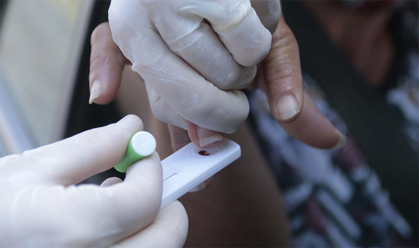 Rondônia é destaque como o Estado que mais testa para a Covid-19 no País