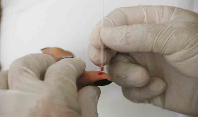 Pesquisa avalia incidência de infecção por Covid-19 em população de Porto Velho