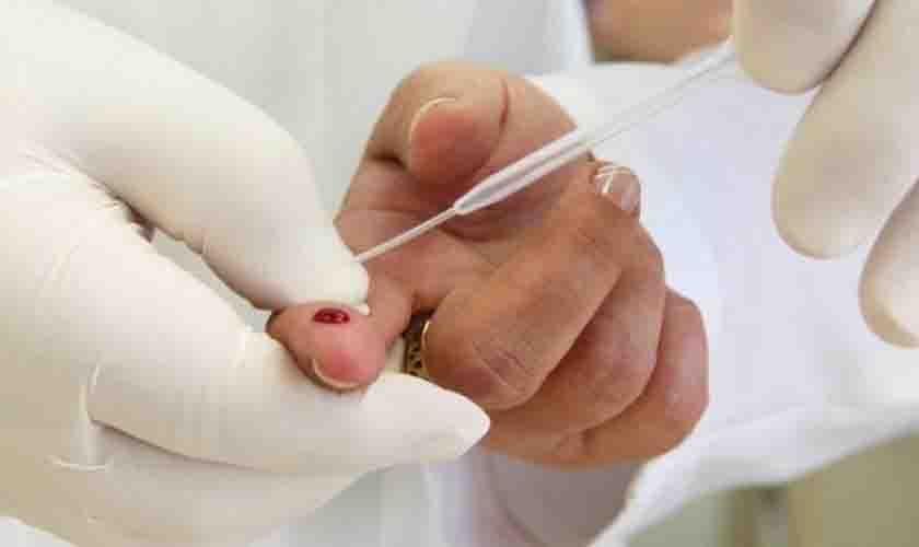 Casos de AIDS aumentam em Vilhena e Saúde alerta a população sobre a prevenção