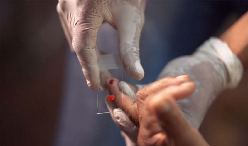 Ministério da Saúde quer zerar casos de malária no país até 2035