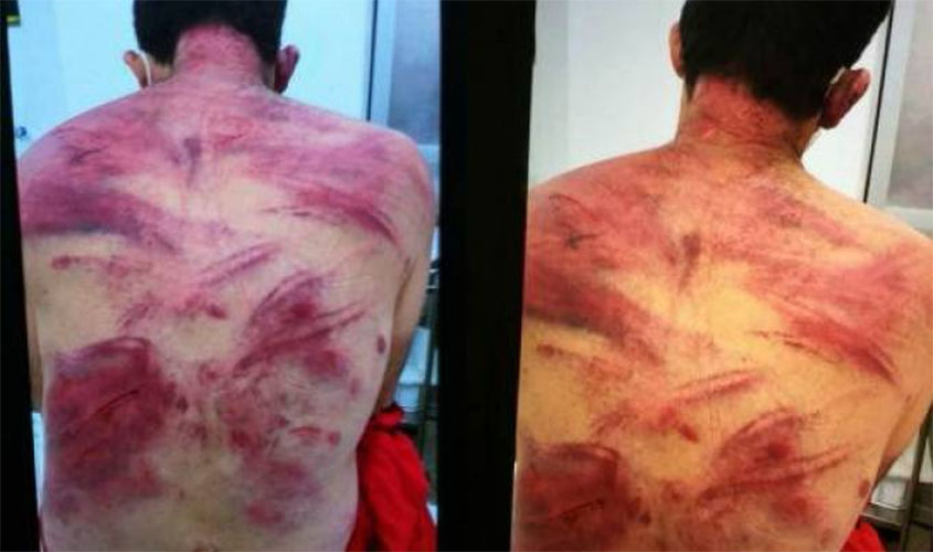 Devido risco iminente de morte, suspeito de matar casal de dentistas ficará isolado na Cadeia Pública