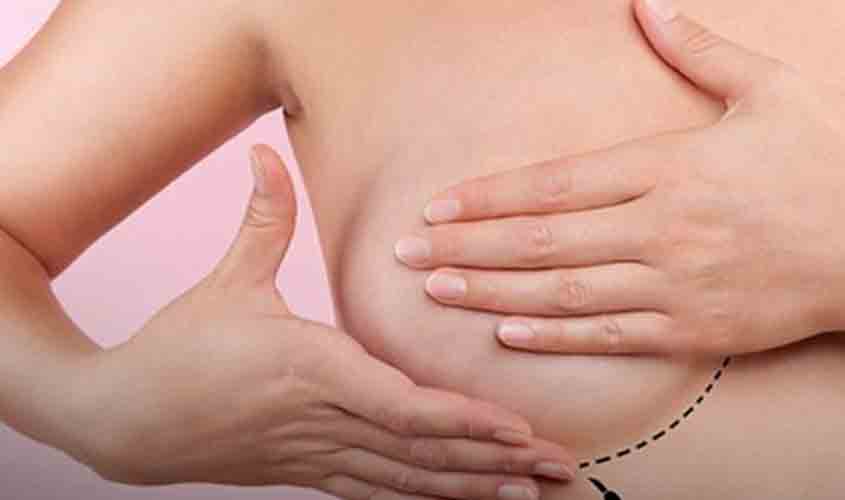 Mastologistas brasileiros buscam experiência da Índia para diminuir mortalidade por câncer de mama