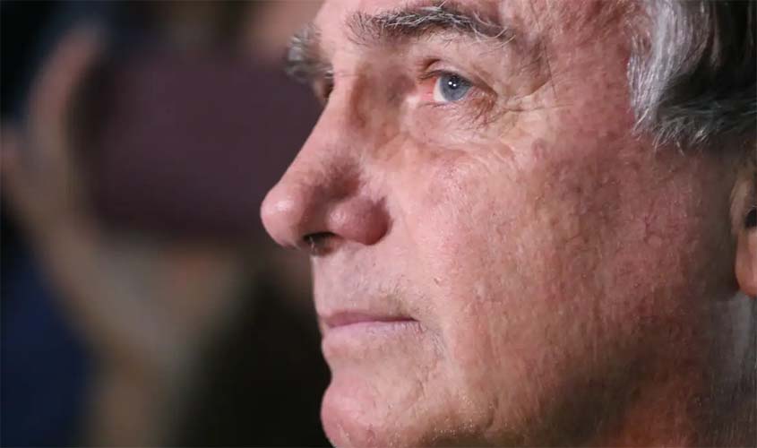 Moraes manda PF periciar Bolsonaro após pedido de cirurgia