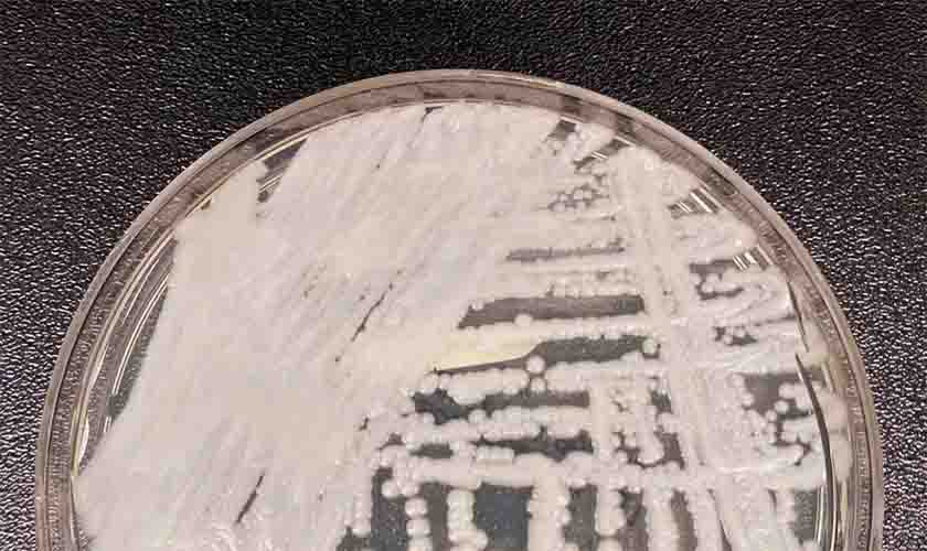 Anvisa confirma novo caso do superfungo Candida auris