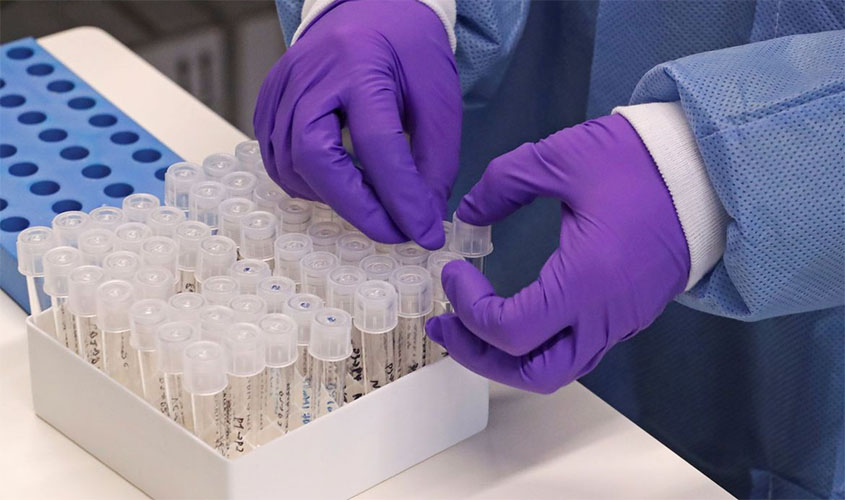 Rio de Janeiro confirma transmissão local do coronavírus