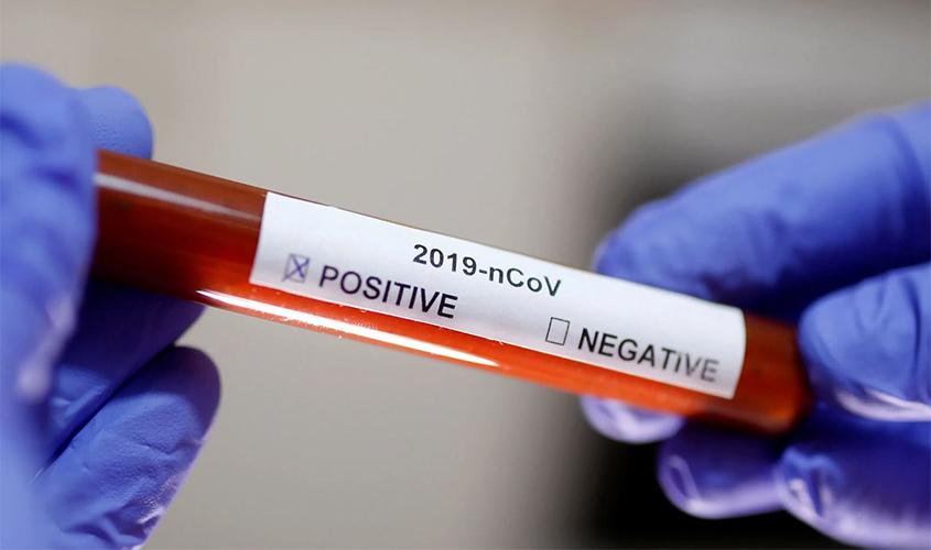 Brasil tem 22,1 mil casos de covid-19; mortes chegam a 1,2 mil