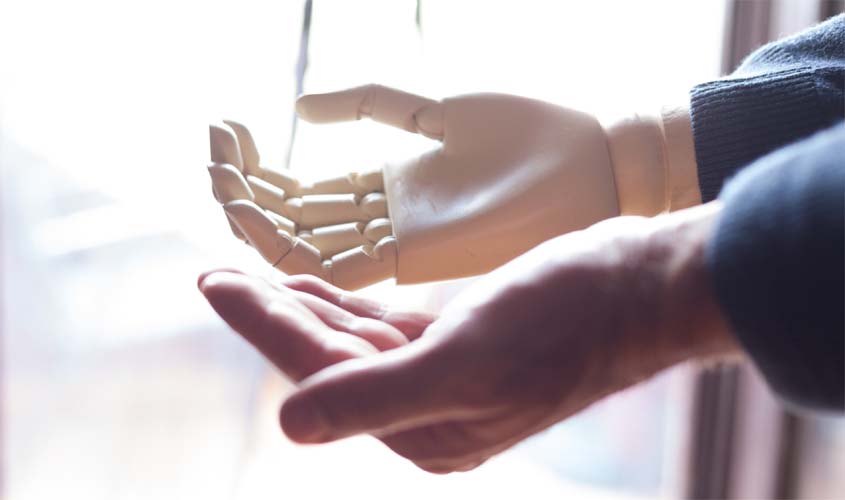 Prótese fornecida pelo INSS não será descontada de indenização a empregado que perdeu a mão