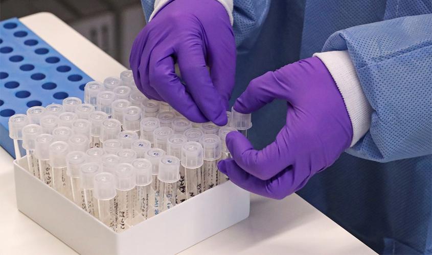 Saiba tudo sobre o novo coronavírus e a doença que ele provoca