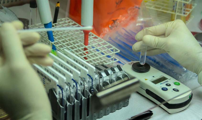 Agevisa e Lacen celebram termo de cooperação que fortalecerá os sistemas de vigilância em saúde no Estado