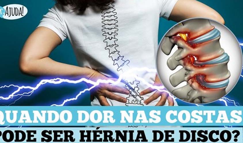 Hérnia de disco: Quando suspeitar? Qual o diagnóstico e o tratamento?