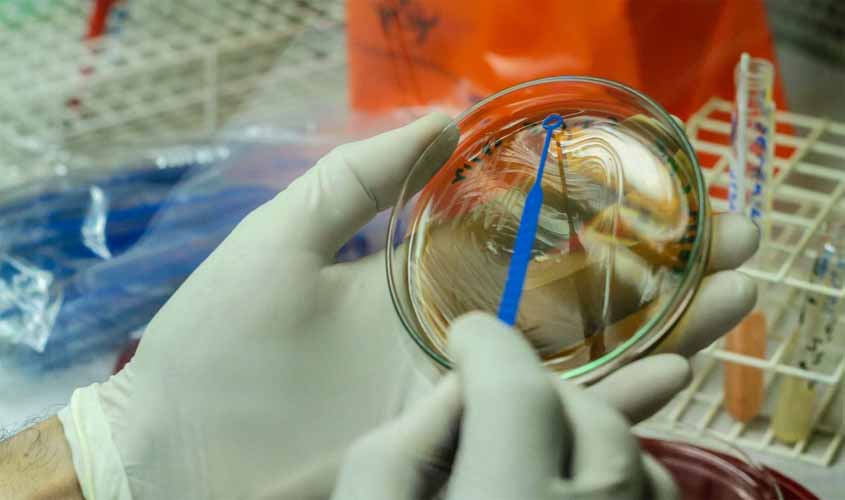 Casos suspeitos de Monkeypox em Rondônia são descartados; resultado é emitido por laboratório referência