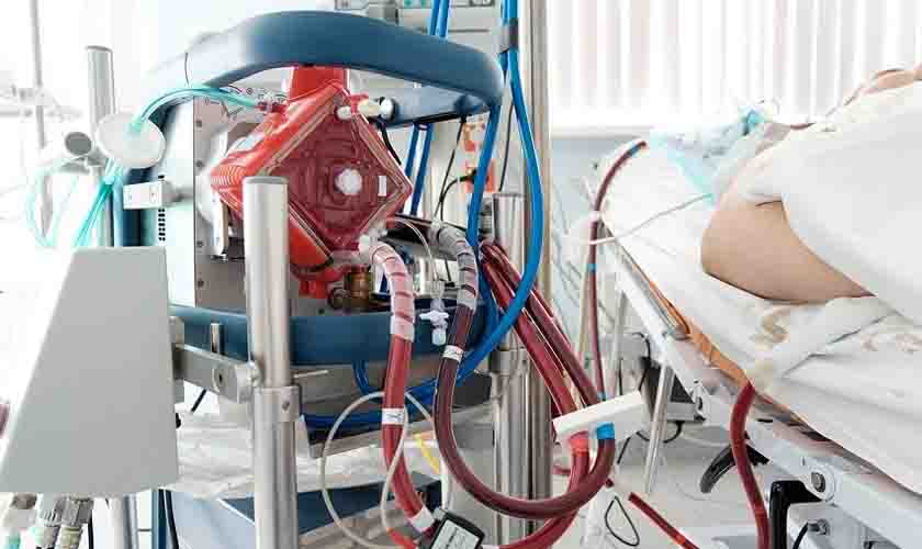 Covid: 2ª onda teve mais mortes de pacientes submetidos ao pulmão artificial, segundo estudos internacionais