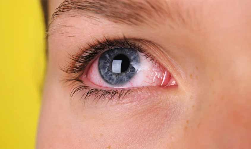 Substâncias químicas em pomadas modeladoras podem causar complicações oculares, informam oftalmologistas