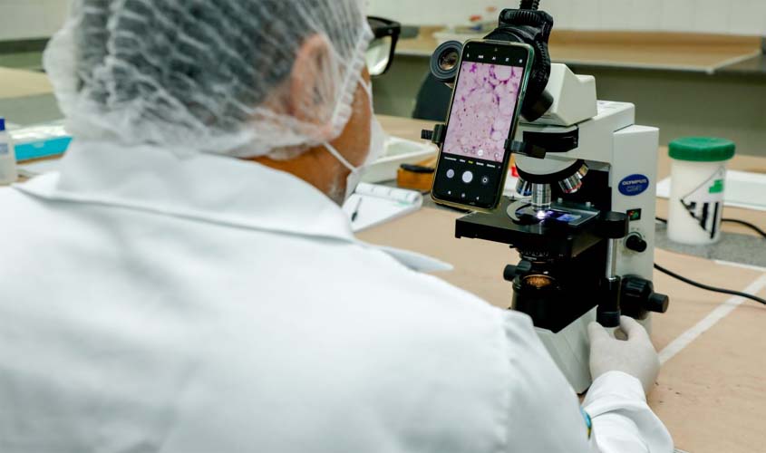 Vigilância reforça prevenção à doença de Chagas