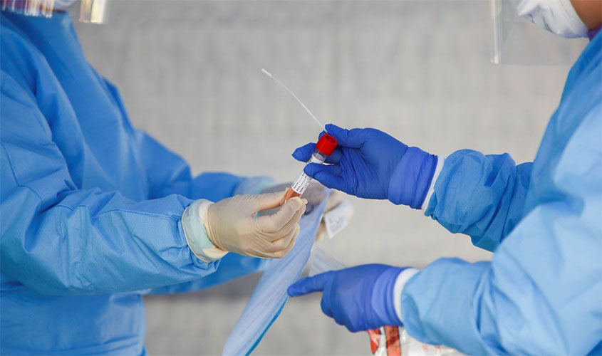 Brasil acumula 867,6 mil casos do novo coronavírus