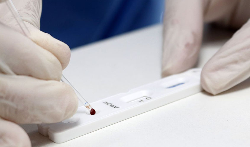 Covid-19: Brasil registra 106.523 mortes e 3,27 milhões de casos