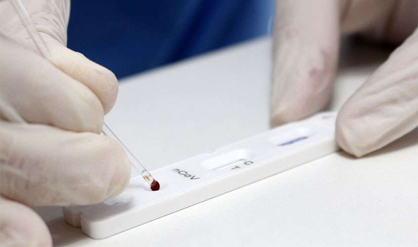 Covid-19: Brasil registra 106.523 mortes e 3,27 milhões de casos