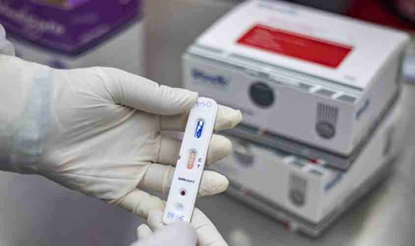 Estou com Covid-19, e agora? Médicos respondem o que fazer