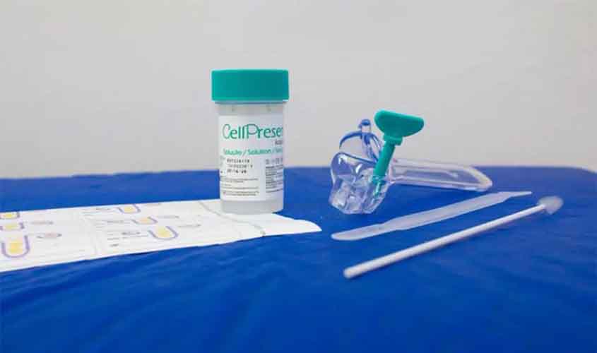 Saiba como é o novo teste do SUS para detectar câncer de colo do útero