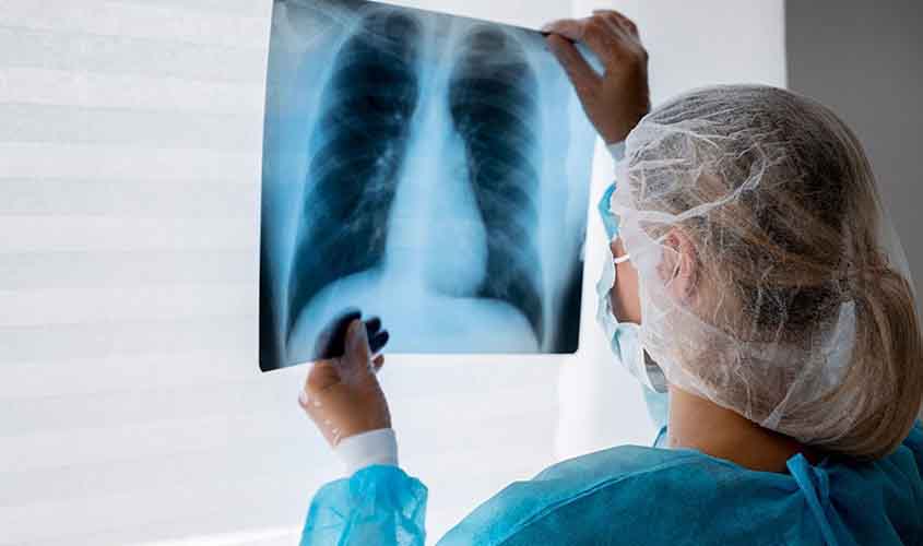 Lei institui campanha para conscientização sobre câncer de pulmão