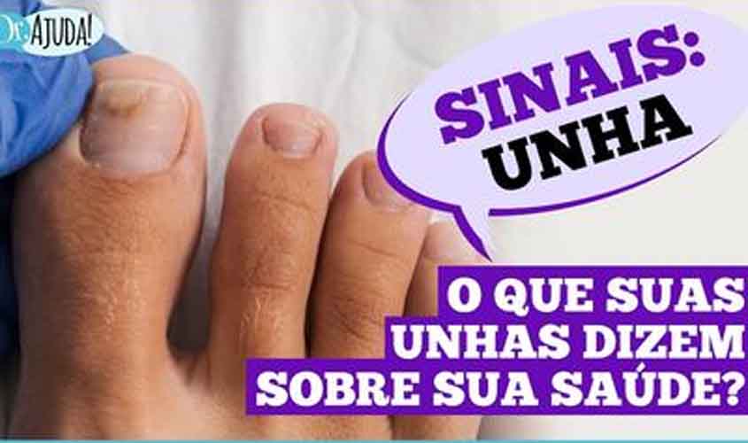 Unhas fracas ou manchadas? Descubra o que sua saúde pode estar revelando