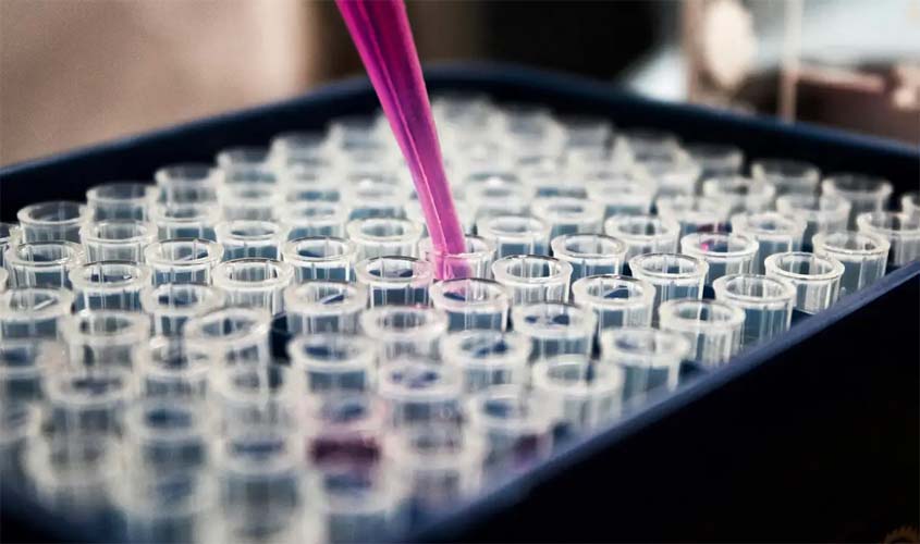 Estudo mostra que inflamação no cérebro pode ser chave do Alzheimer