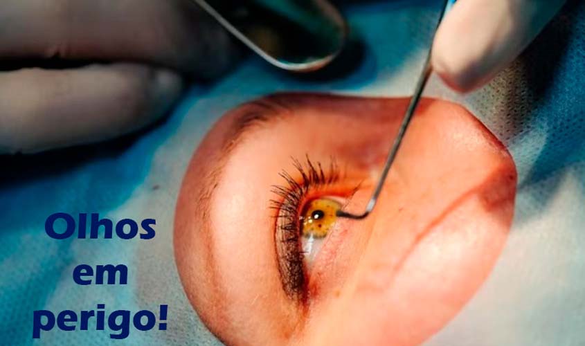 Mutirões inadequados provocam danos graves aos olhos