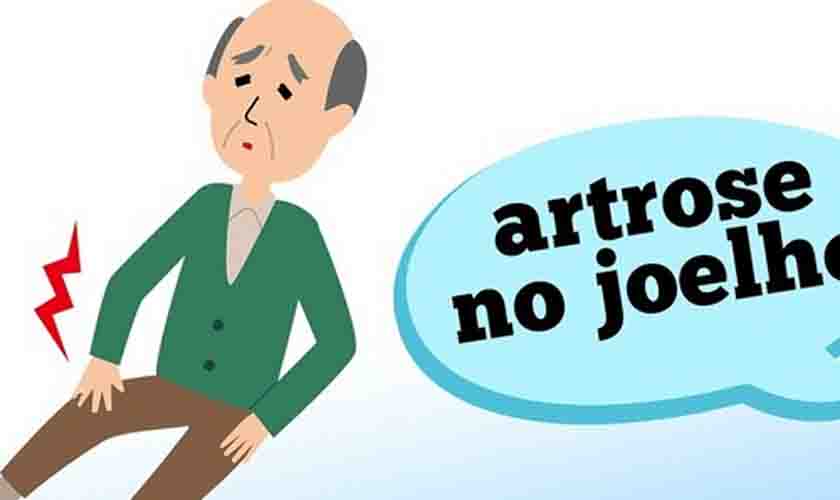 Artrose no joelho: quando devo suspeitar?