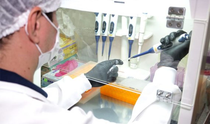 Governo de Rondônia compra 6 mil amostras de PCR para realização de exames da Covid-19 no Lacen