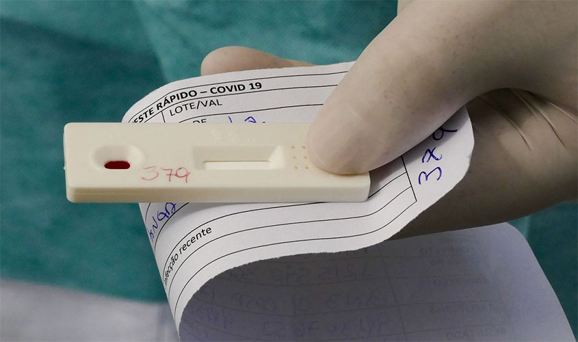 Brasil chega a 2 milhões de casos acumulados de covid-19