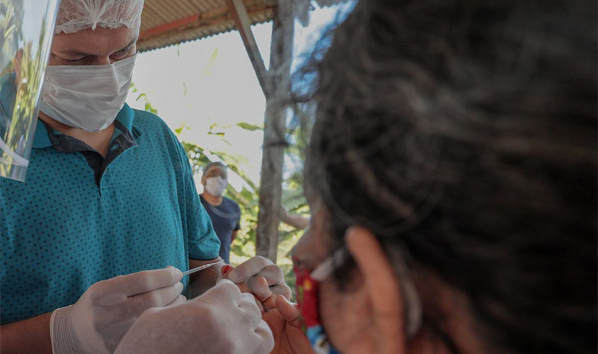 Profissionais de saúde orientam o momento mais adequado para fazer o teste da Covid-19