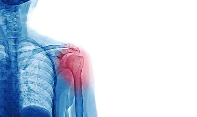 Nexo Técnico Epidemiológico não serve para comprovar doença ocupacional de auxiliar
