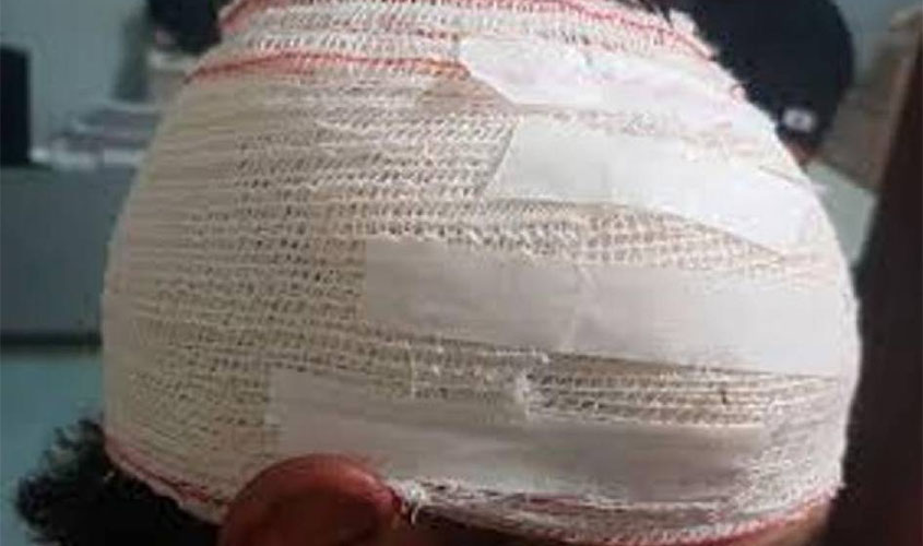 Mulher de 53 anos tenta matar o próprio filho a pauladas enquanto o rapaz dormia