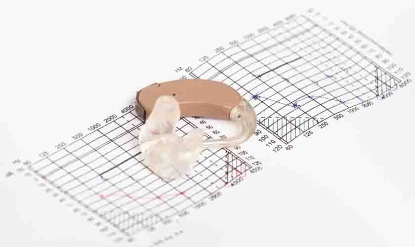 Operador de máquina receberá pensão por perda parcial da audição