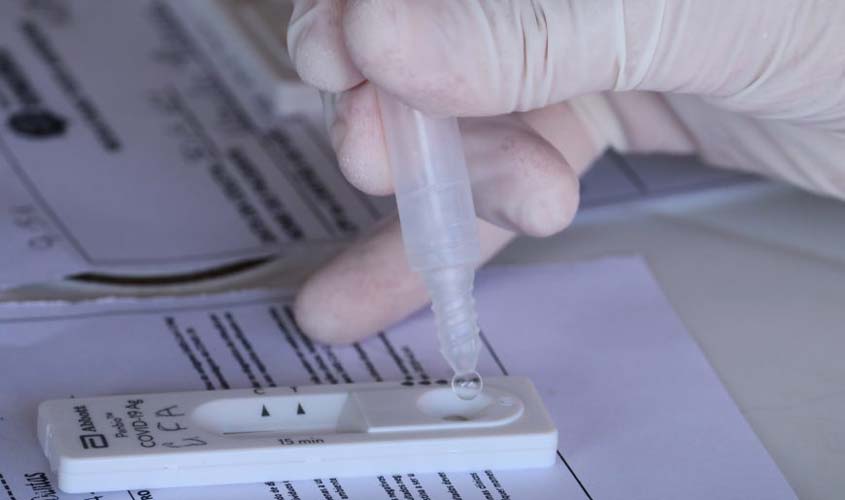 Boletim diário sobre o coronavírus em Rondônia