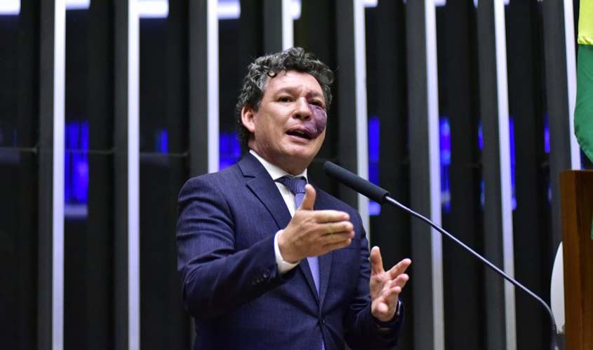 Deputados ressaltam simplificação como ponto principal da reforma tributária