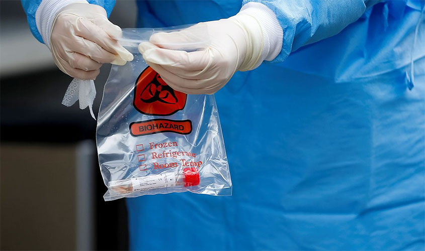 Casos confirmados de covid-19 entre indígenas chegam a 23