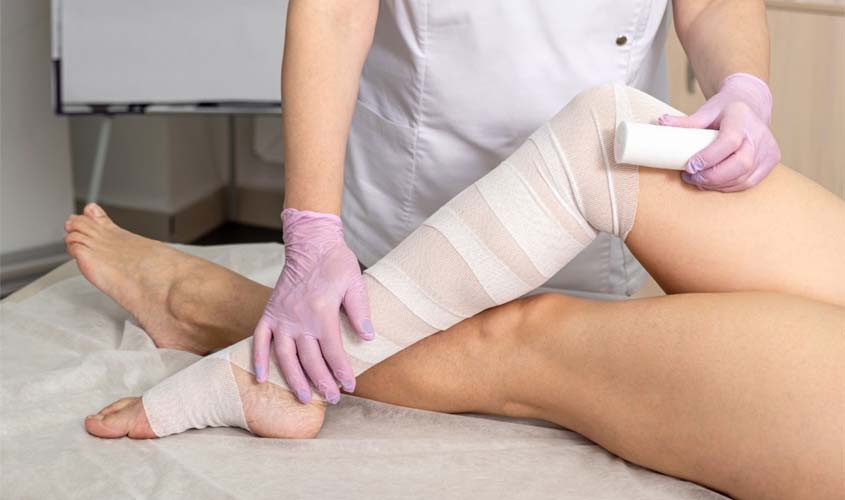 Perguntas e respostas rápidas sobre lipedema