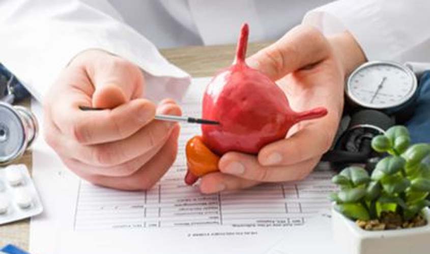 No mês da prevenção do câncer de bexiga, conheça os sinais da doença