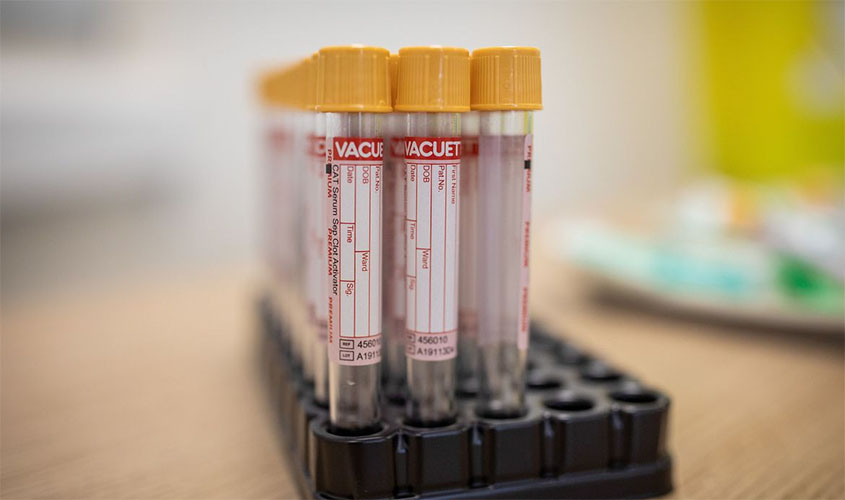 Covid-19: Brasil acumula 4,4 milhões de casos e 134,9 mil mortes