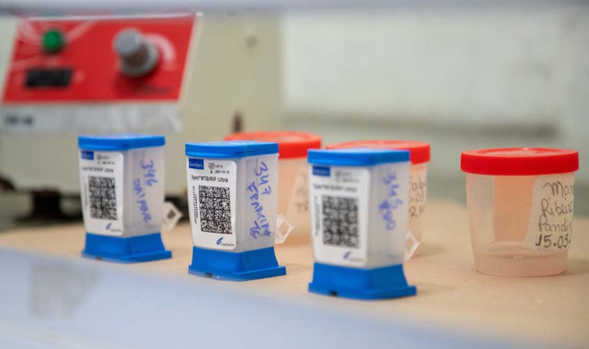 Dia Nacional de Combate à Tuberculose reforça a importância de medidas preventivas contra a doença