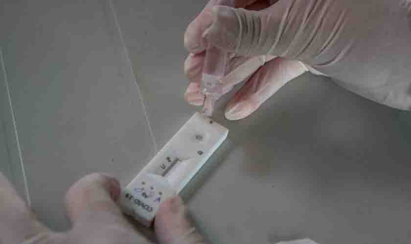 Rondônia registra 51 casos da variante Ômicron em nove municípios