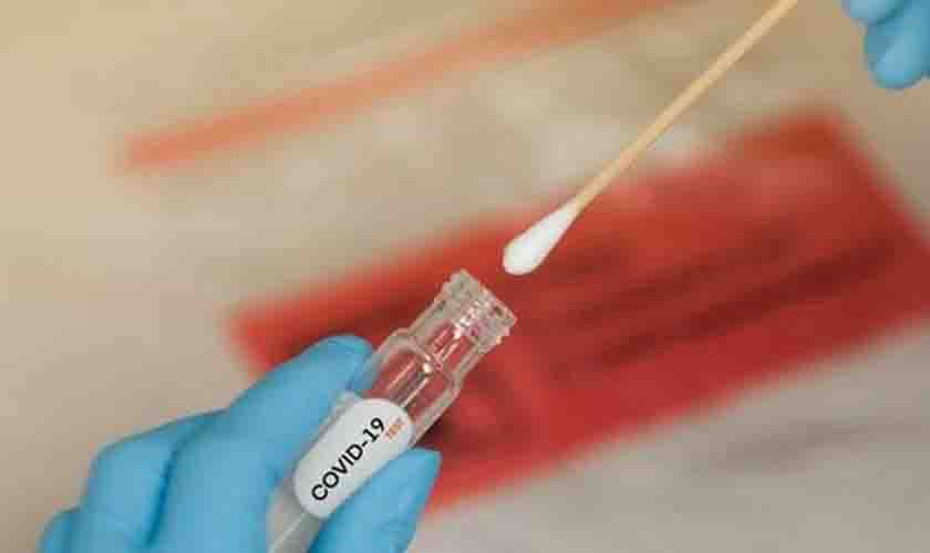 Covid-19: pode fazer o teste depois de tomar a vacina?