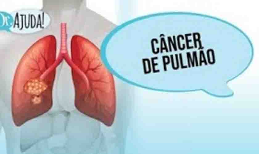 Câncer de pulmão é um dos mais comuns no Brasil