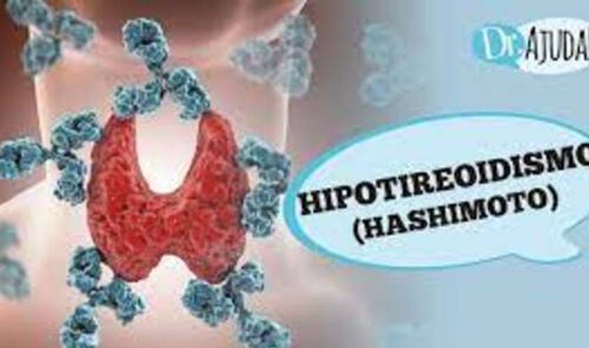 Quando suspeitar de hipotireoidismo?